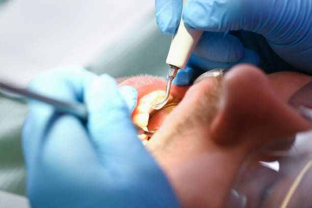 Best Walk-In Emergency Dental Services in Olive Branch, MS