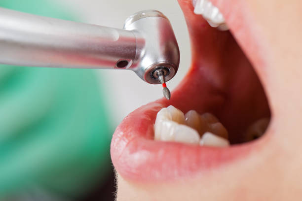 Best Emergency Cosmetic Dentistry (e.g., broken veneers) in Olive Branch, MS